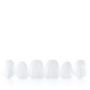 facetas cerâmicas estética dentária