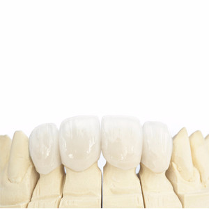 COROAS DENTÁRIAS 1