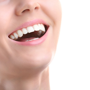 branqueamento dentário